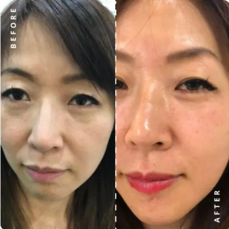 Anti Aging Treatment