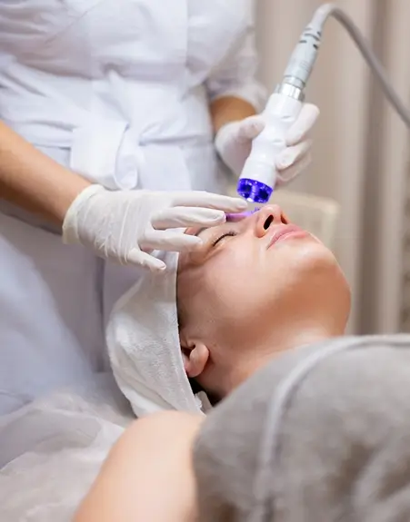 Skin Laser Treatment