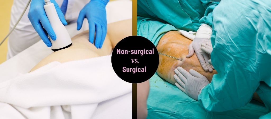 Non-Surgical vs Surgical Liposuction