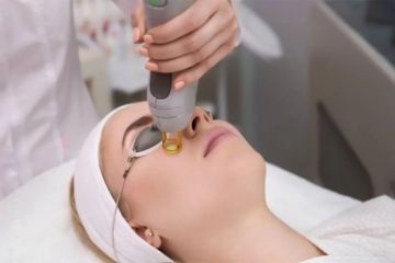 Skin Laser Ttreatment