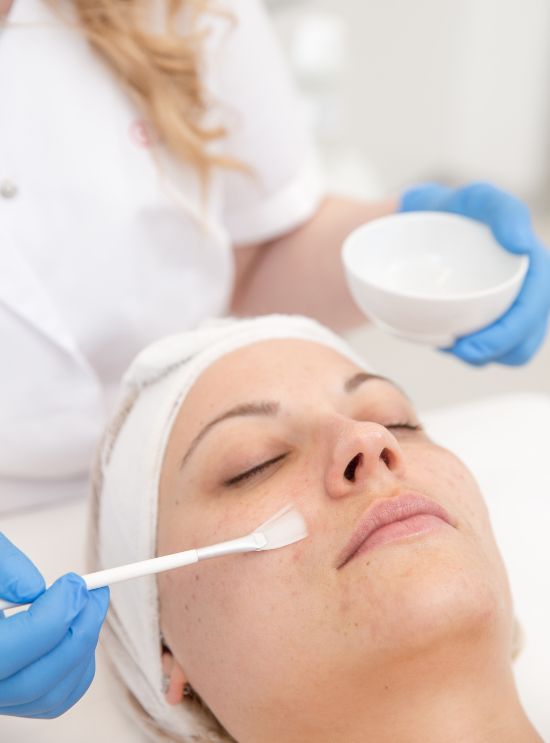 Chemical Peel Treatment