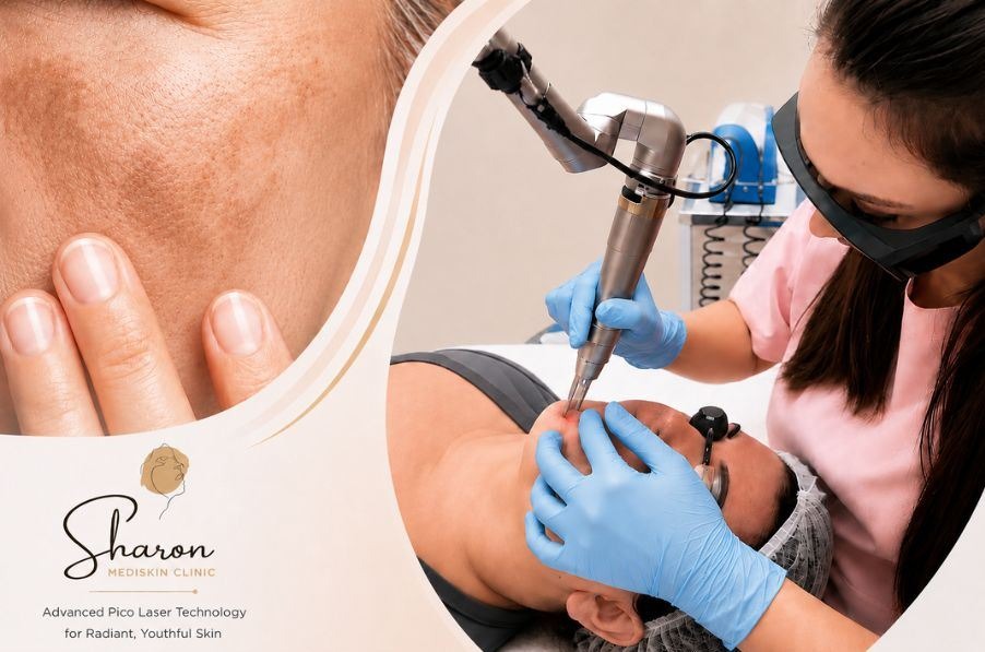 Pico laser treatment