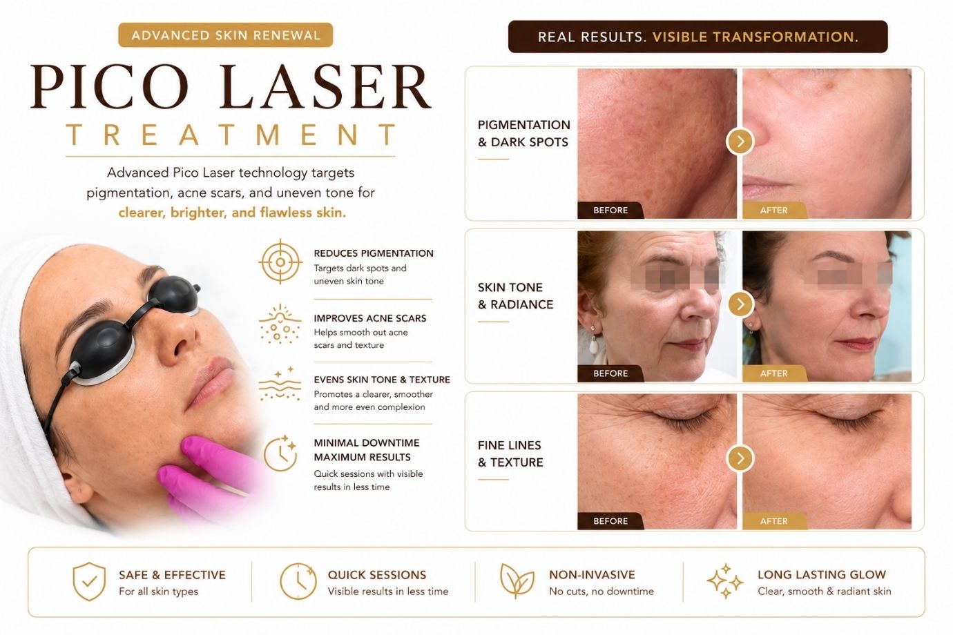 Pico Laser Treatment by Sharon