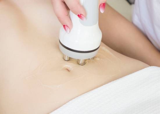 Radiofrequency Body Treatments