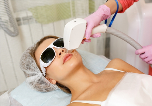 Laser Skin Treatments