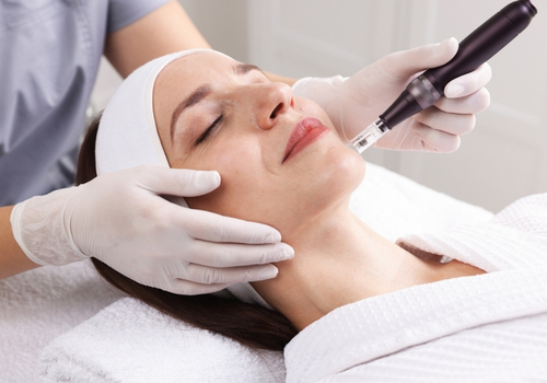 Skin Needling